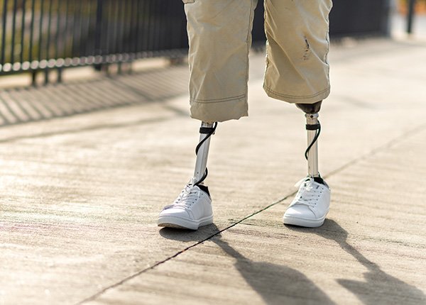 XI. Uluslararası Protez-Ortez Kongresi’nde Sözlü Bildiri Sunumu Image